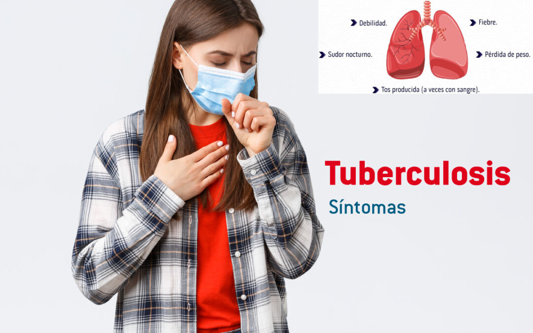 Tuberculosis – síntomas